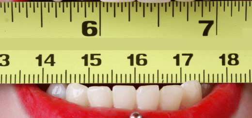 Erreurs de superficie : quelles conséquences sur le prix ?